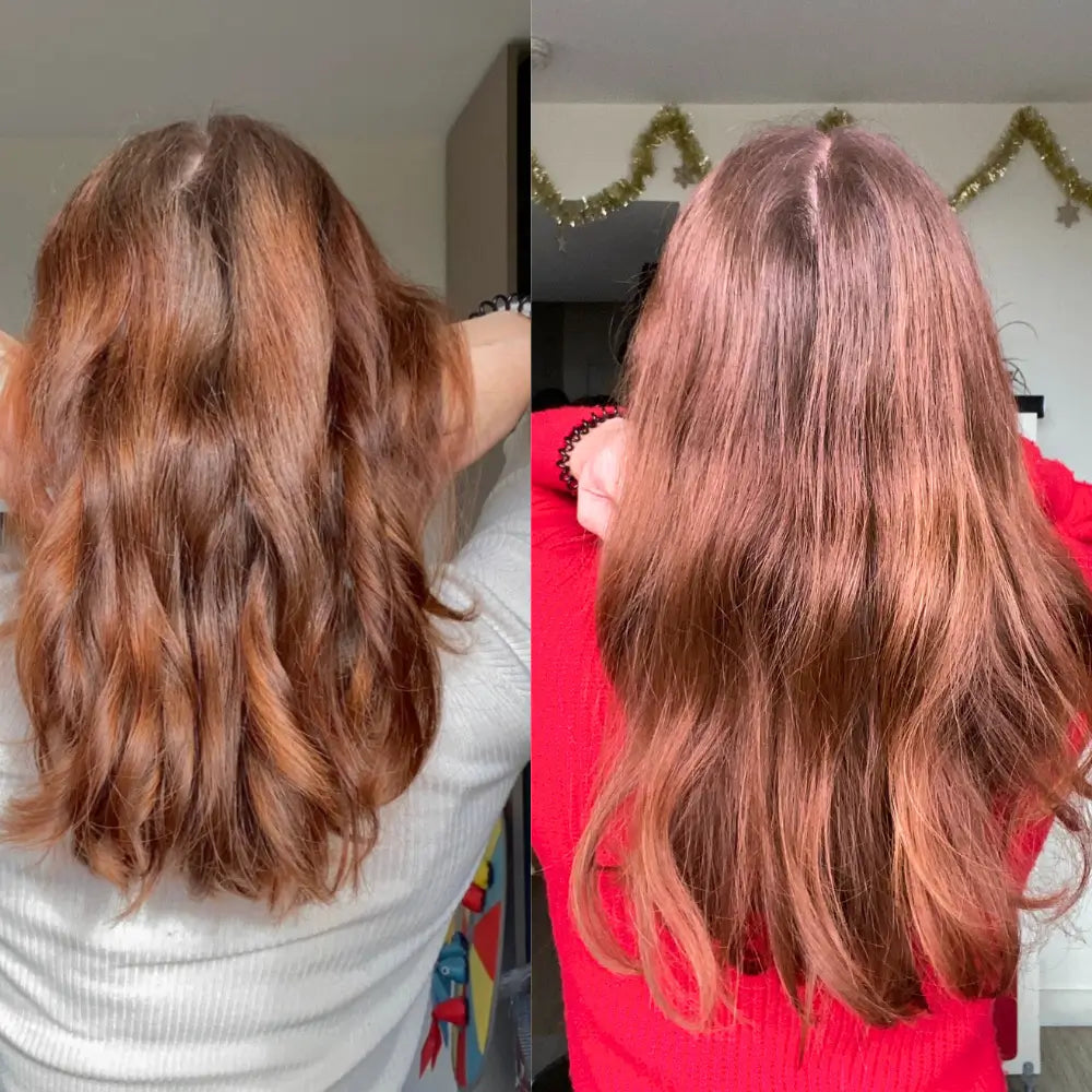 Kit Crescita Completo - 3 mesi