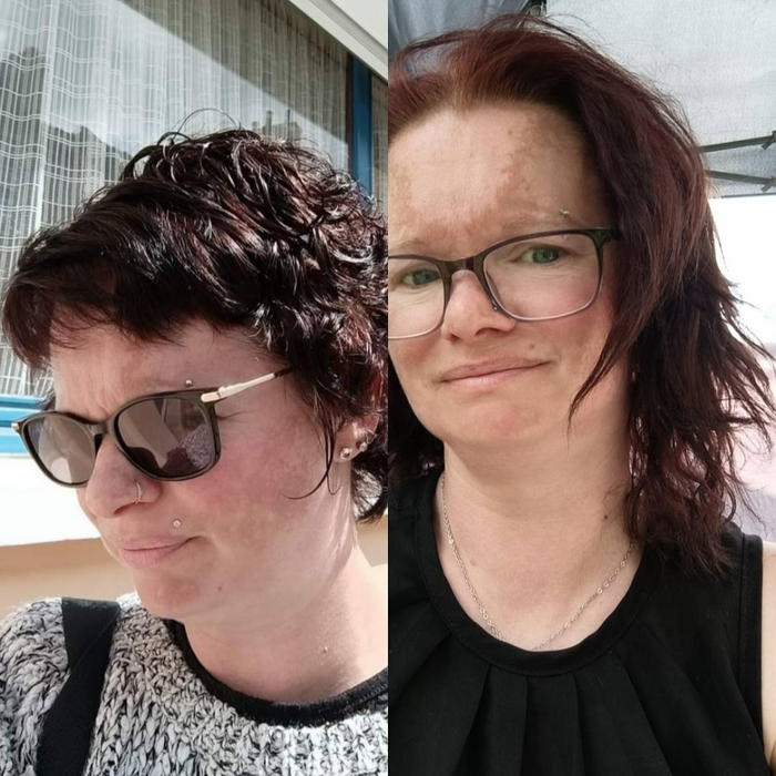 kit-menopause-ugc — avant / après Marie, 6 mois